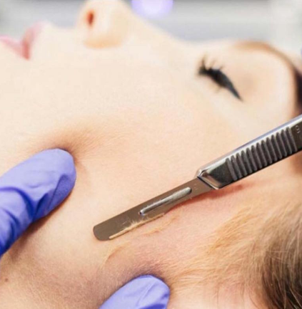 Dermaplaning